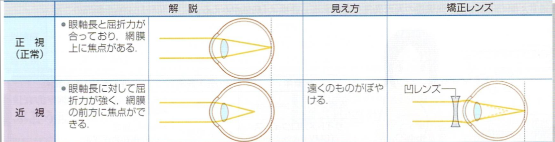 老眼とは
