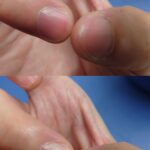 猫背は何故駄目なの？