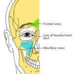 鼻炎と蓄膿と鍼灸