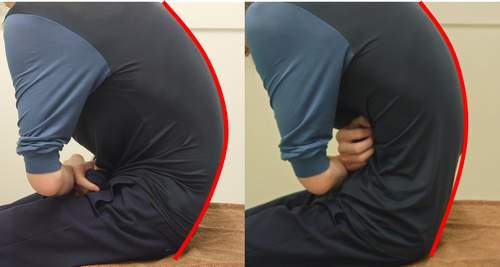 慢性腰痛の腰の硬さ