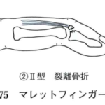 医療用語の齟齬
